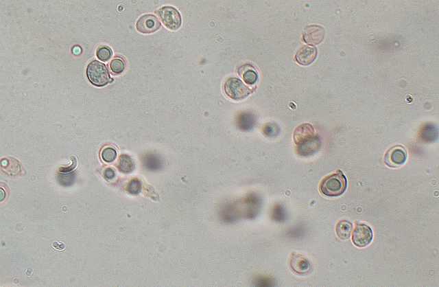 Hydropus atramentosus     (Kalchbr.)    Kotl. & Pouzar